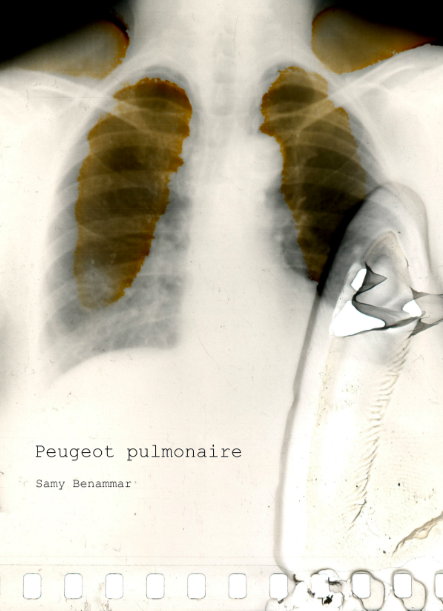 Peugeot pulmonaire