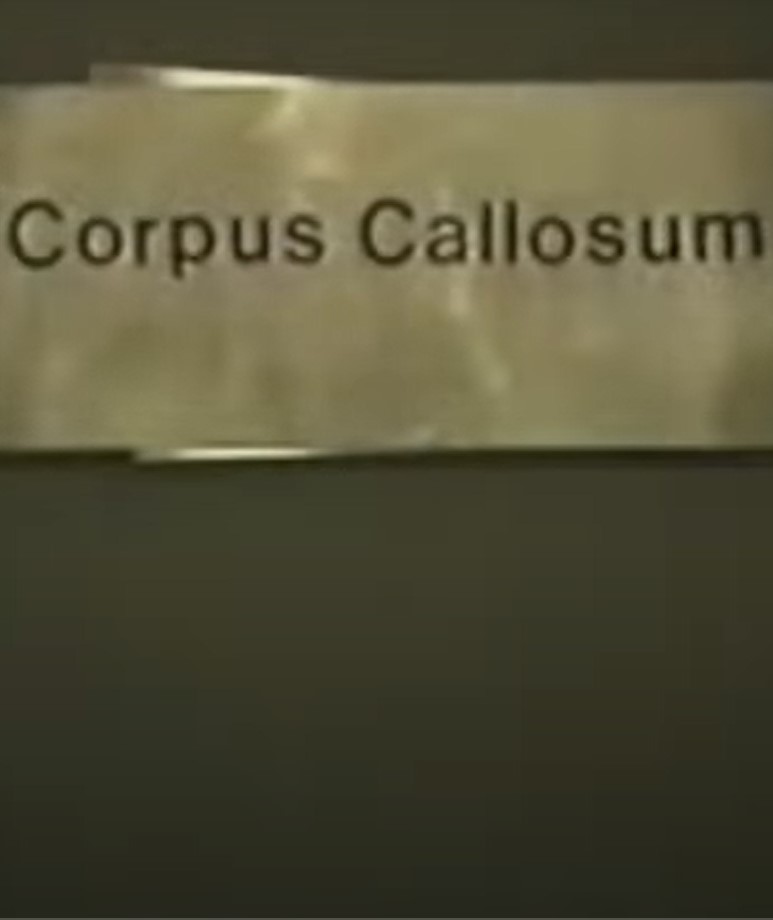 Corpus Callosum